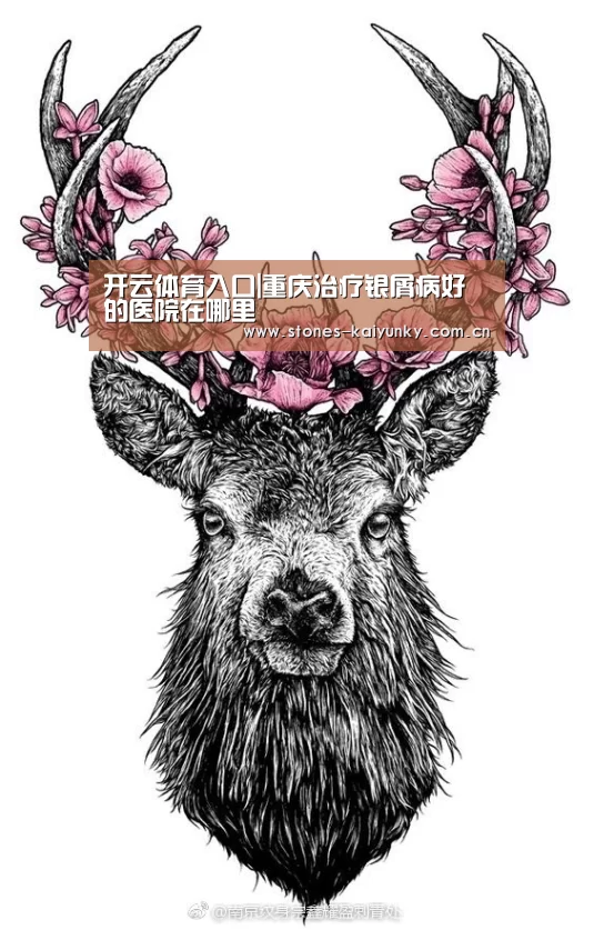 开云体育入口|重庆治疗银屑病好的医院在哪里(图3) 开云